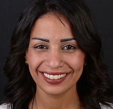 שחזורים דנטליים הכי טובים