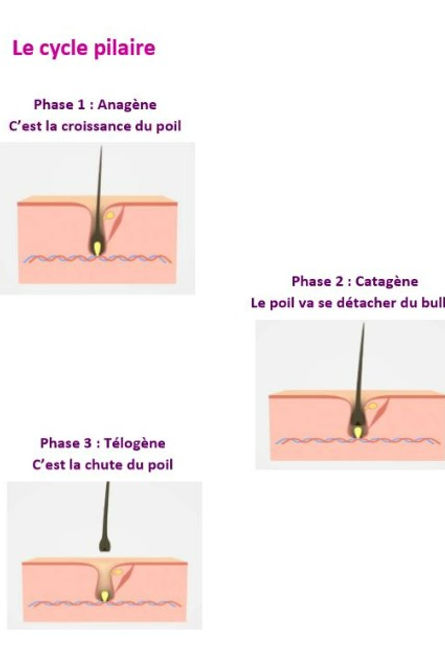 Cycle pilaire, épilation laser