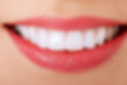 Smile Design – Your Dream Smile Awaits