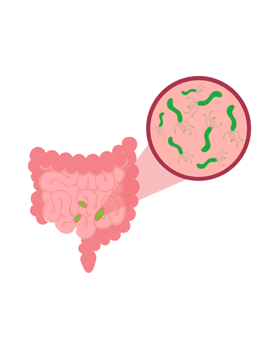 Bacterial overgrowth in the small intestine. Majority of bacteria should be in the large intestine.