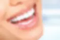 holly-wood-smile-turkey (1).webp