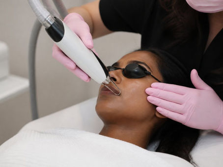 Laser Facial for Brown Skin: What to Expect