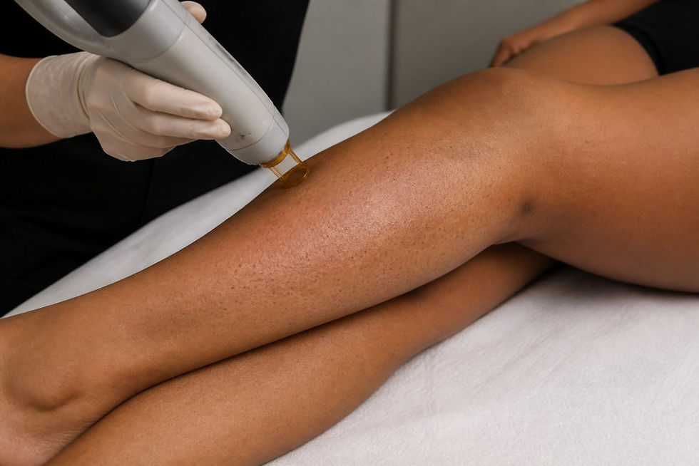 Why Laser Hair Removal Fails for Some: Key Causes