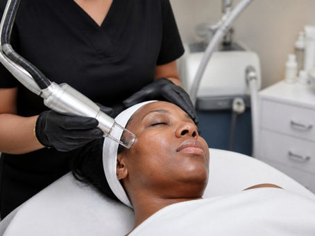 Prepare for Laser Skin Resurfacing on Dark Skin