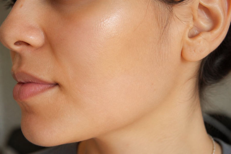 Close-up of a person's cheek showing smooth, glowing skin with refined texture after dermaplaning treatment in natural window lighting