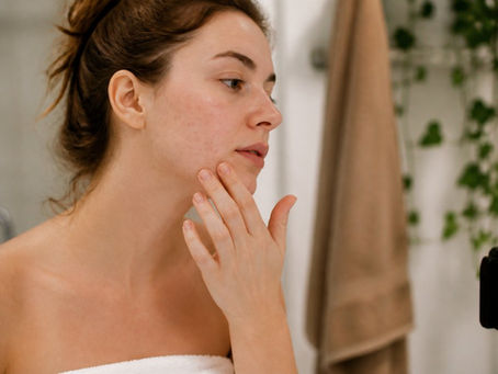 Skincare Routine for Sensitive Acne-Prone Skin