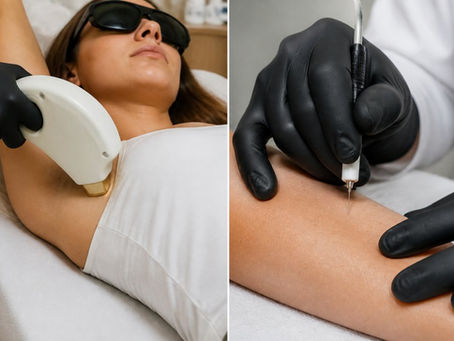 Laser Hair Removal vs Electrolysis for Stubborn Hair