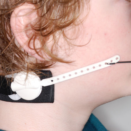 What Is Orthodontic Headgear and Why Might You Need It?