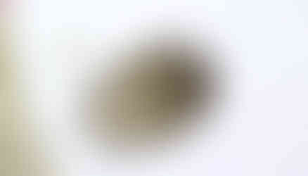 Difflugia type amoeba