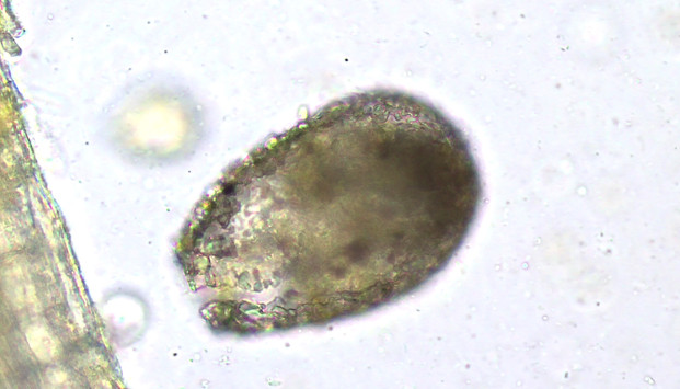 Difflugia type amoeba