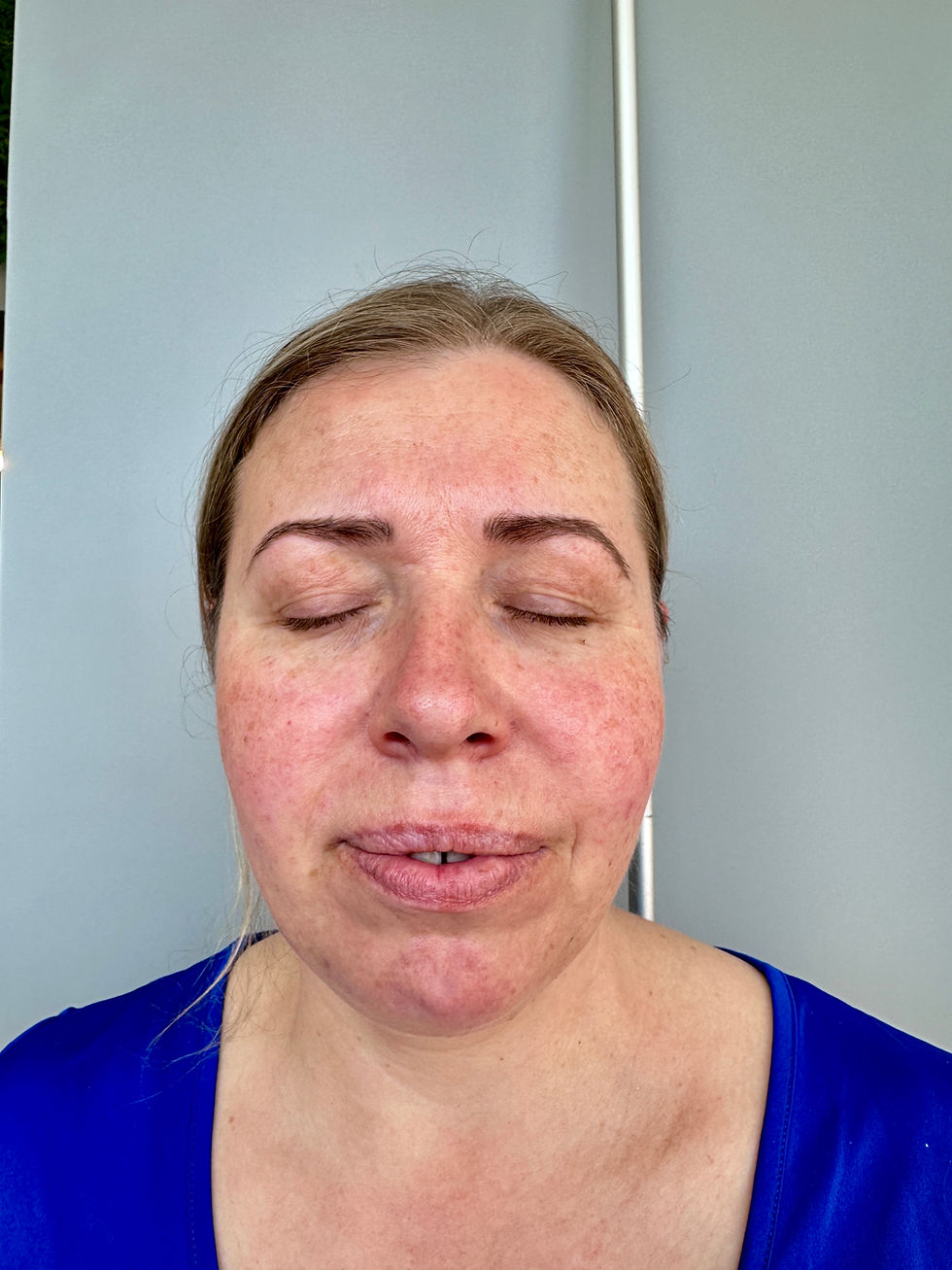 Revolutionizing Skincare: Non-Invasive Facial Near Me with Zemits Technology HydroVerstand at Silesiana Spa Grimsby