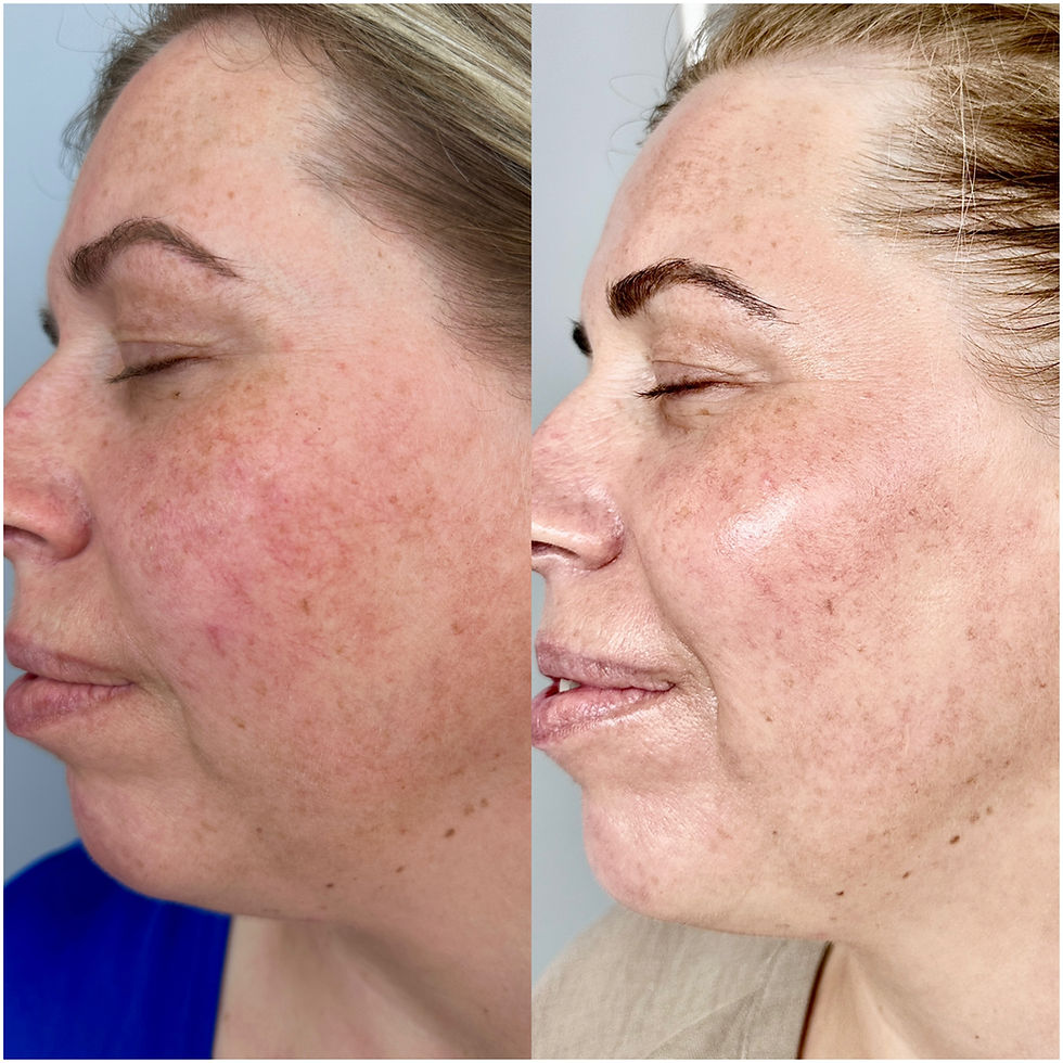 skin redness and dark spots