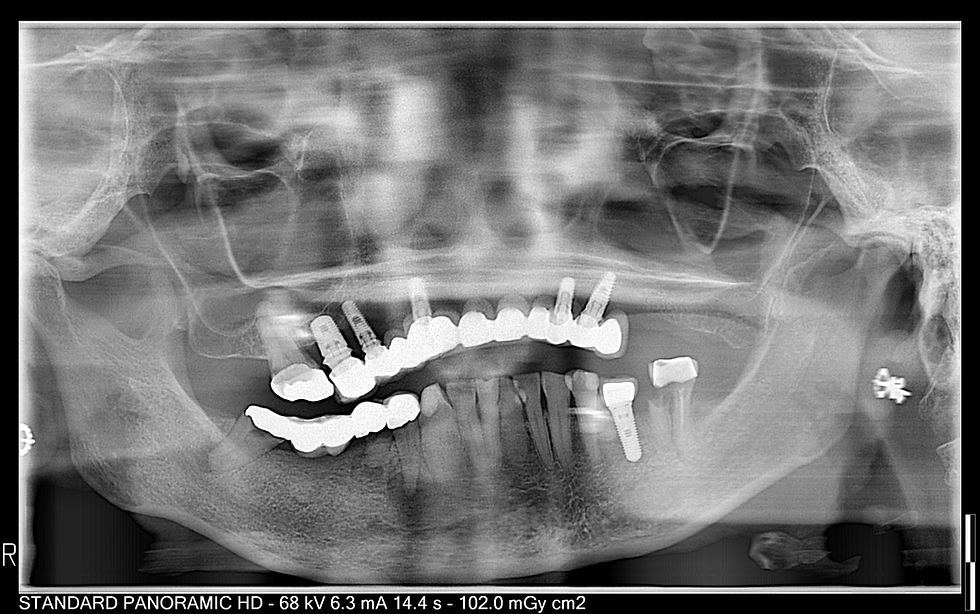 allonx before pano.jpg