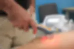 Move-Osteopathy-Cold-Laser-Therapy.webp