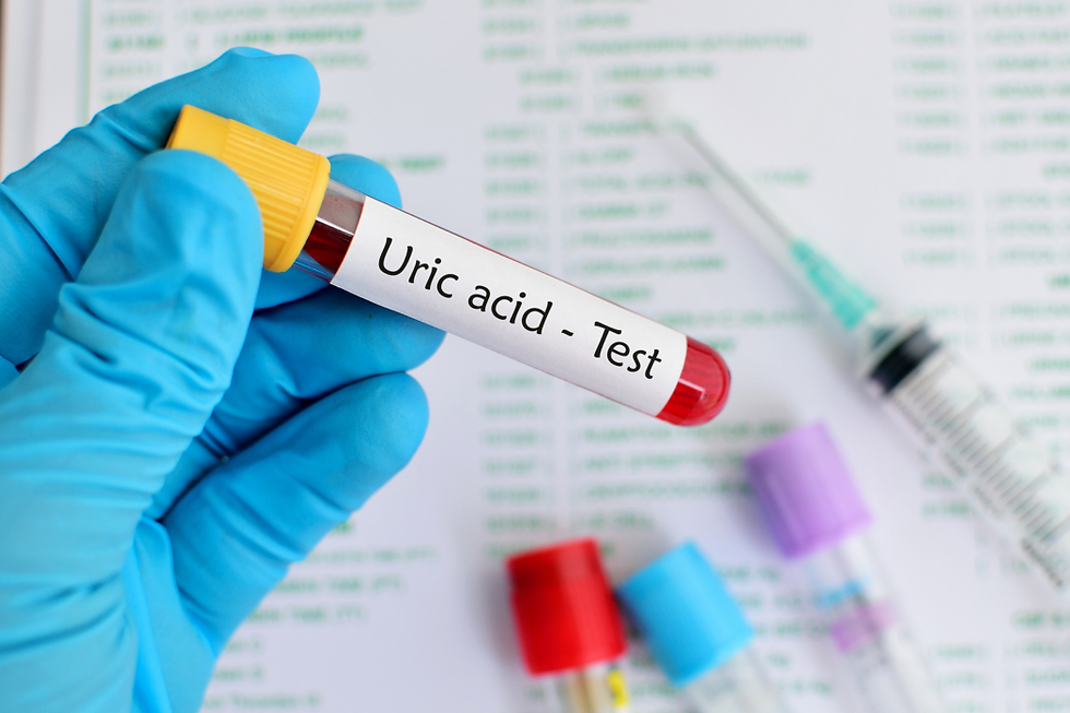 The Apex Predator's Blind Spot: Why Uric Acid is the"New Cholesterol"