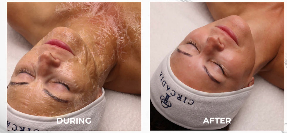 LuxeLift Anti-Aging
