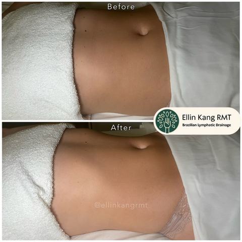 Body lymphatic drainage
