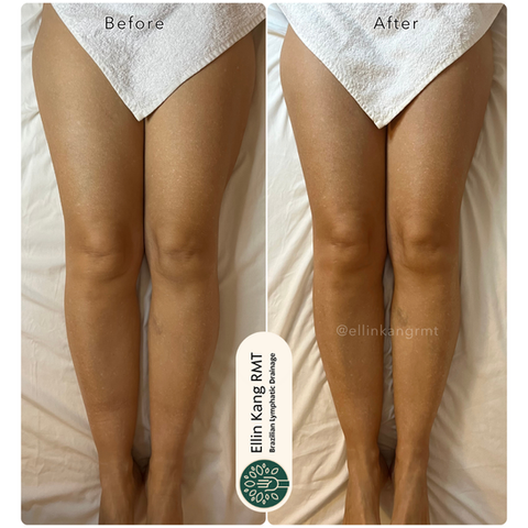 Body lymphatic drainage