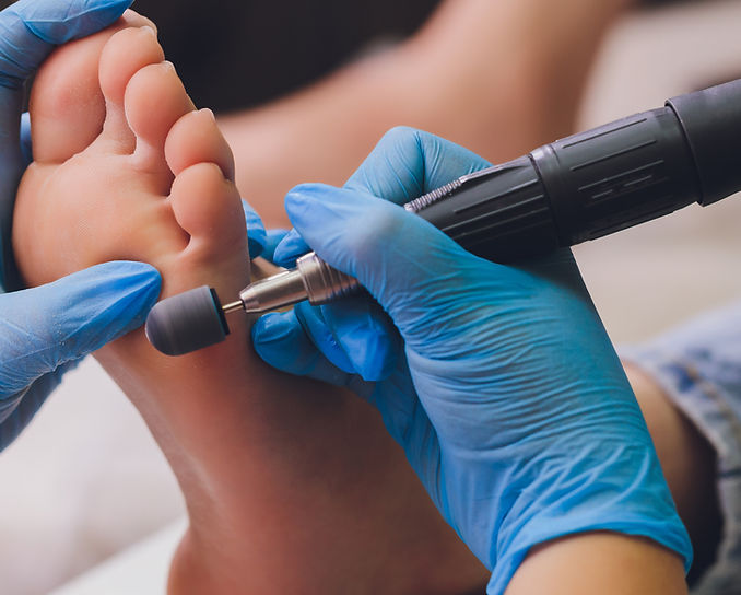 medicinsk fotvård på äldreboende i Nacka oc Stockholm.