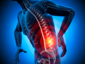 After your Acupuncture Treatment for back pain...