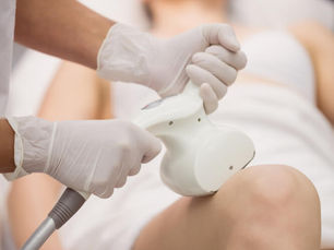 Animações 3D: A solução visual que está impulsionando as vendas de máquinas de depilação a laser