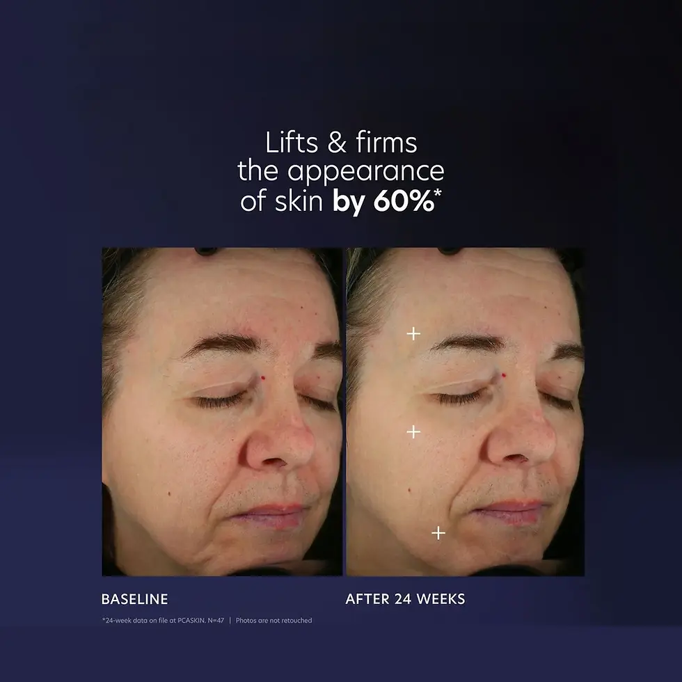 Thumbnail: PCA Skin Pro-Max Age Renewal Serum