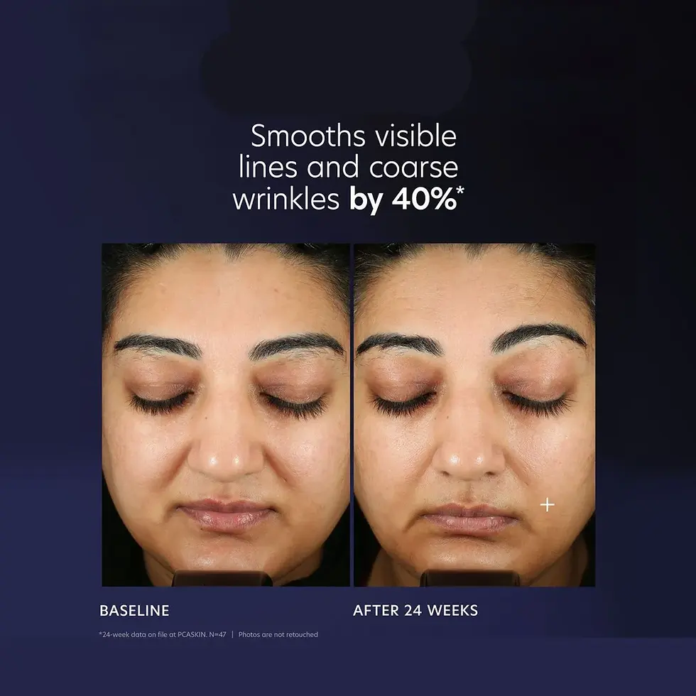 Thumbnail: PCA Skin Pro-Max Age Renewal Serum