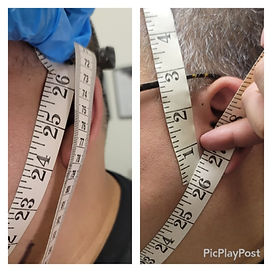PCDC Fat Loss Shots before-and-after at Body FX Houston highlighting effective, non-surgical fat reduction for a more toned and defined look. Double Chin Fat Loss in Just 1 Sessions