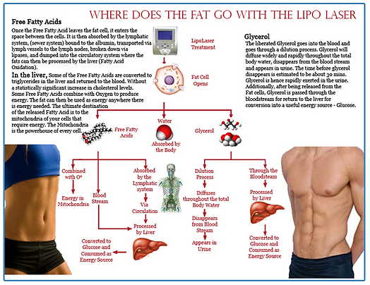 At Body FX Houston, our laser lipo treatment uses advanced low-level laser technology to target and shrink fat cells, helping reduce stubborn areas while tightening skin. This painless, non-surgical body contouring option supports inch loss, smooths problem areas, and pairs perfectly with other treatments for enhanced results