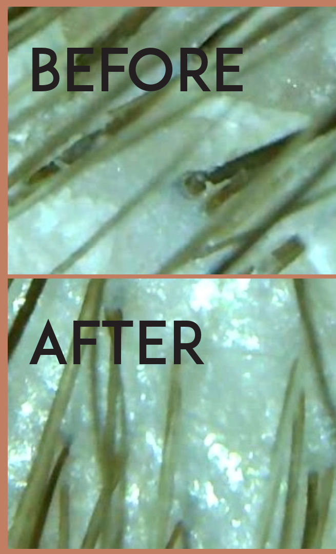 Scalp Buildup: What It Is, What Causes It, and How to Actually Treat It