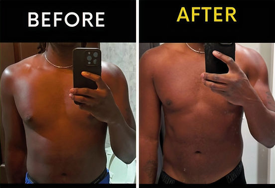 Post ACL surgery (Before and After)