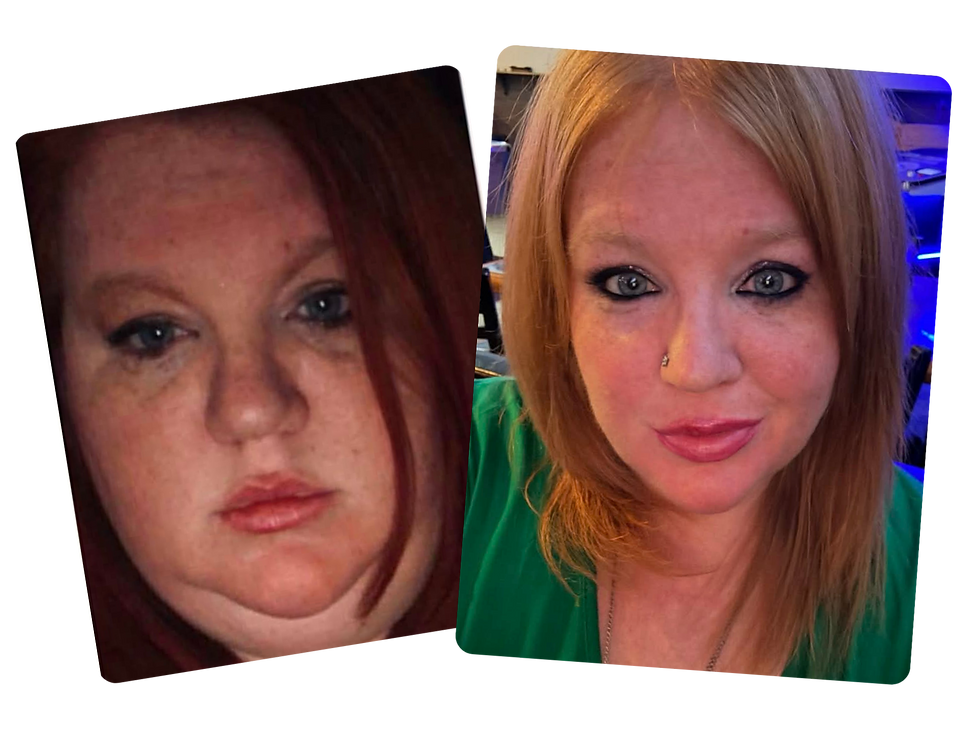 transformation-img.png