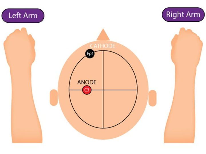 Motor-Ability-Reducing-pain-tDCS-2 2.jpg