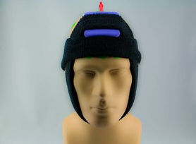 tDCS-Montage-Impulse-Control-in-ADHD-Placement-Examples-1 5.jpg