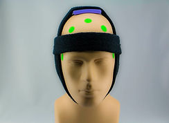 tDCS-Montage-Visual-Motor-Reaction-Times-Placement-Examples-1 5.jpg