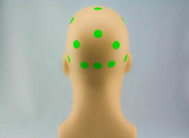 tDCS-Montage-Insightfulness-Creativity-Placement-Locations-5 2.jpg