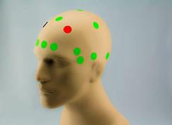 tDCS-Montage-Risk-Taking-Placement-Locations-8 5.jpg