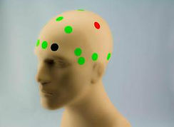 tDCS-Montage-Motor-Ability-Pain-Placement-Locations-8 3.jpg