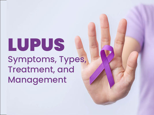 Lupus: Symptoms, Types, Treatment, and Management