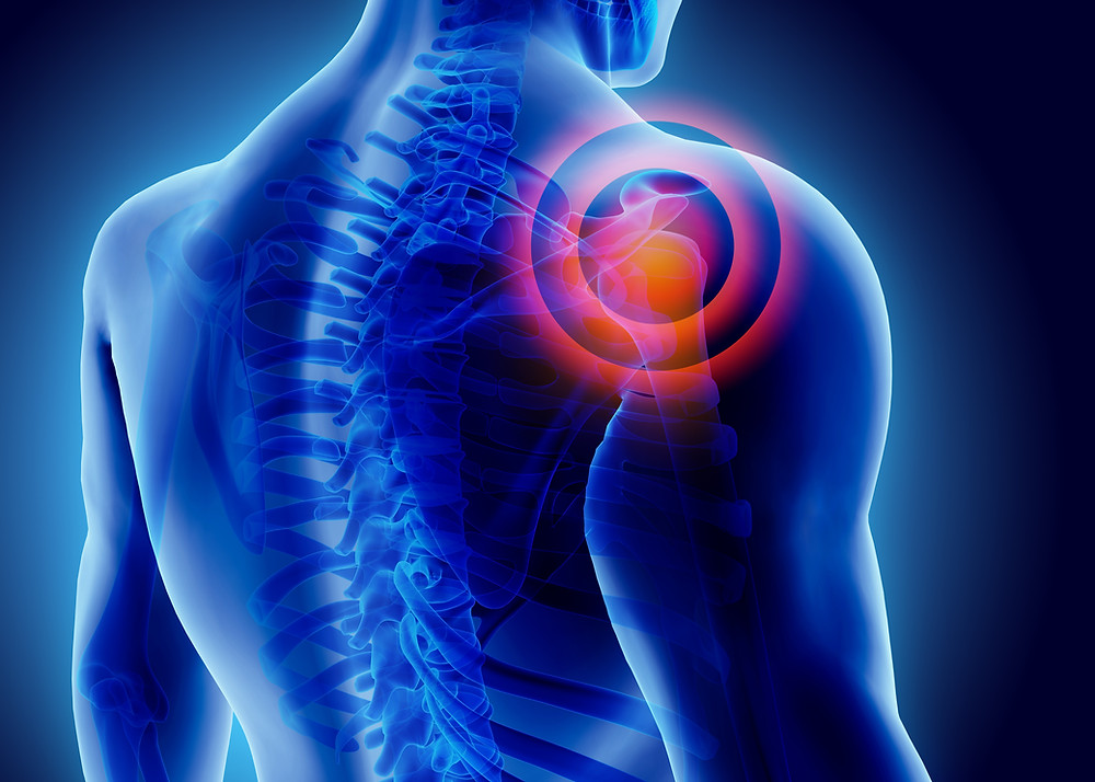 illustration of shoulder joint pain