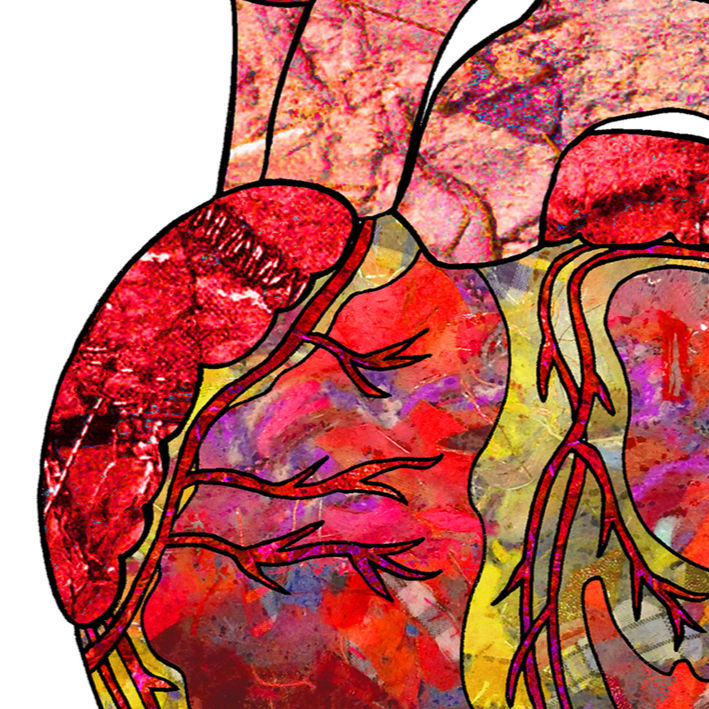 Thumbnail: Personalised Heart surgery get well card, Cardiac, Coronary bypass, Heart valve.
