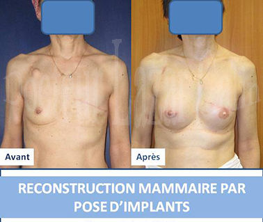 Reconstruction Dr Lazar 1