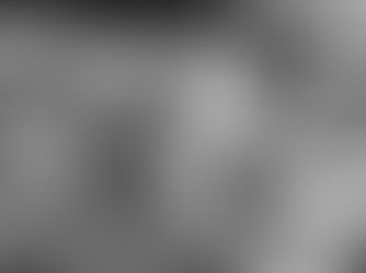 Dolor de oído y fisioterapia