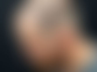 Plättchenreiches Plasma nach einer Haartransplantation