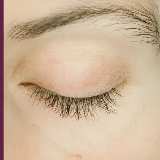 Thumbnail: Lash & Brow Enhancer Serum