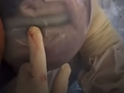 Viral, imágenes de bebé dentro de su bolsa amniótica