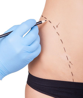 A Complete Guide to Mommy Makeover Surgery Beverly Hills.jpg