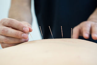 Complementary Therapies at Physiolistic, Henley on Thames