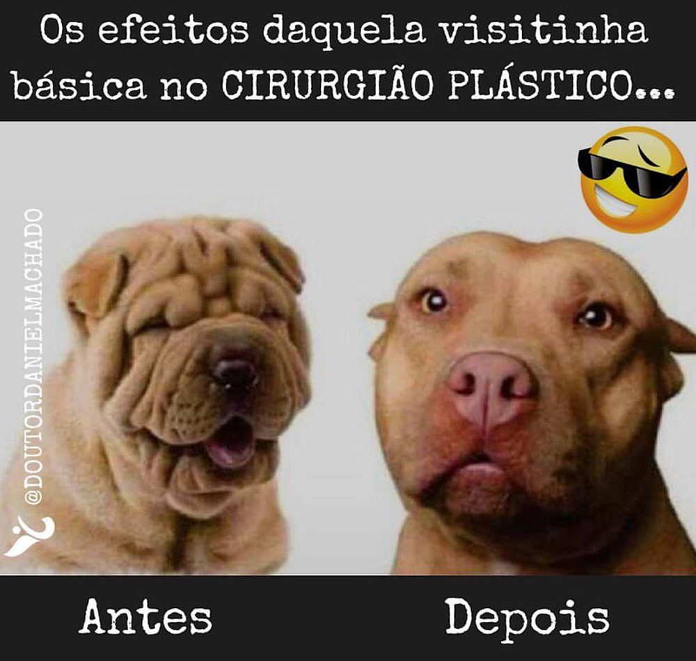 Mais sobre Rejuvenescimento Facial - Botox - Blefaroplastia