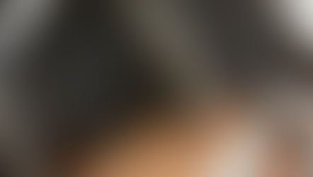 Kepek Neden Olur? Kepekten Kurtulmanın En Etkili Yolları